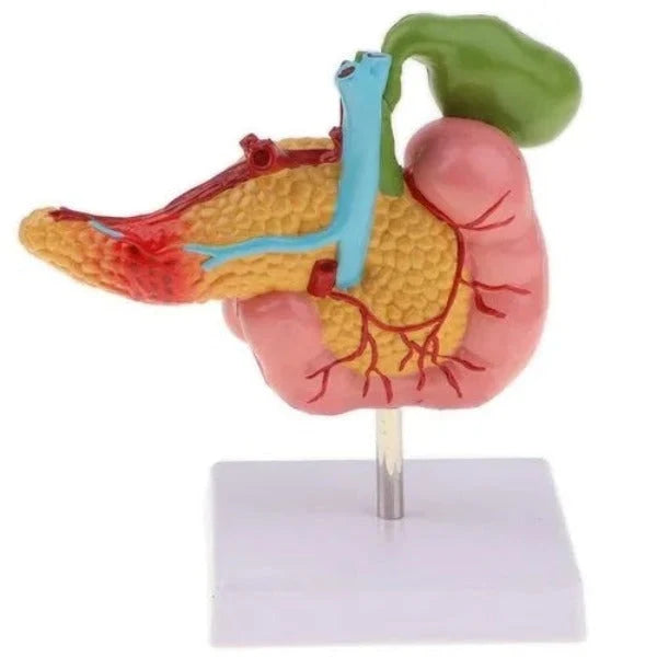 Diseased Pancreas, Spleen and Gall Bladder