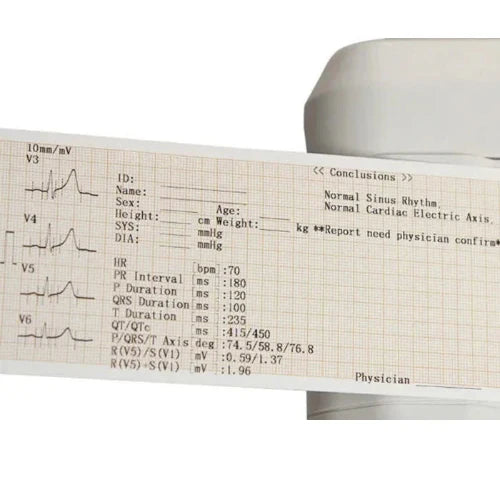 3 Channel ECG Machine with High Quality Waveforms