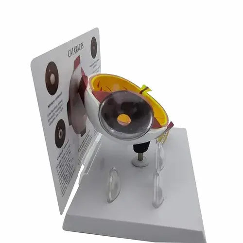 Cataract Eye Model for Patient Education and Training