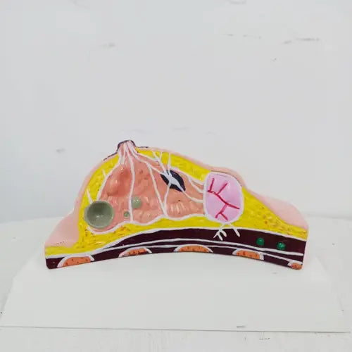 Diseased Breast Model with Common Pathologies
