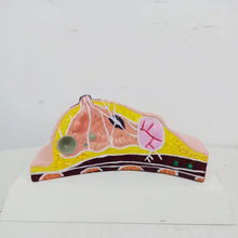 Diseased Breast Model with Common Pathologies