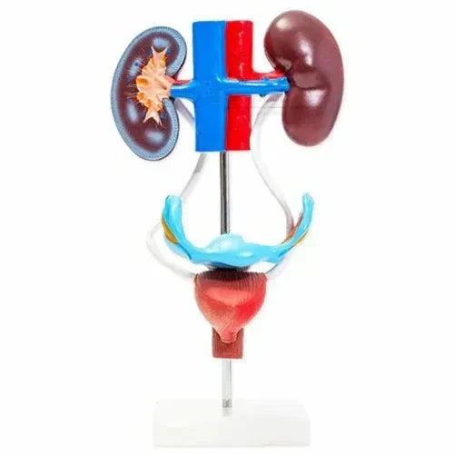 Female Urogenital Model Deluxe with Kidney & Uterus