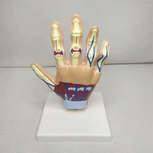 Life-Size Hand Arthritis Model with Cutaway Joints