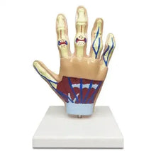 Life-Size Hand Arthritis Model with Cutaway Joints