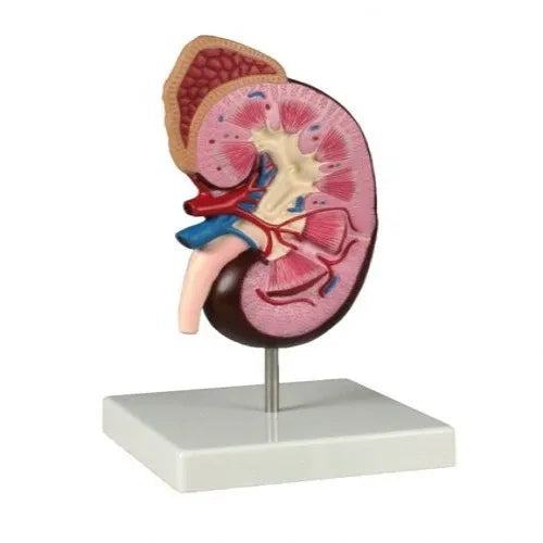 Human Kidney Model Deluxe with Disease Pathologies