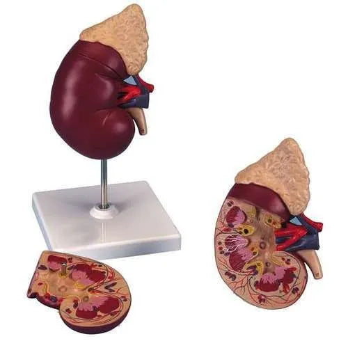 Human Kidney Model Deluxe with Disease Pathologies