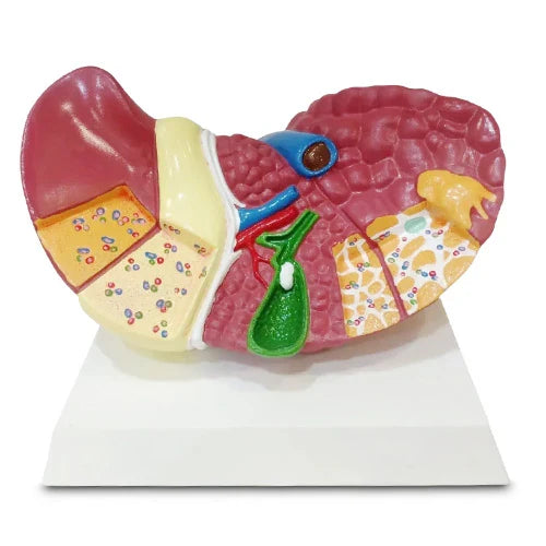 Full-Size Pathological Liver Model with Cirrhosis
