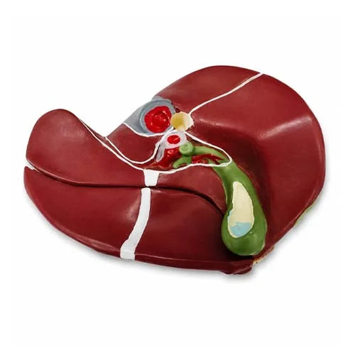 Small Diseased Liver Model with Gallstones & Cirrhosis