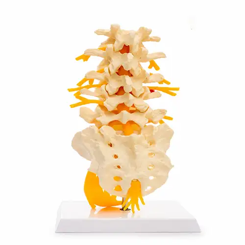 Lumbar Spine Model with Herniated Disc & Sciatic Nerve