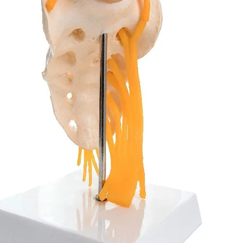 Lumbar Spine Model with Herniated Disc & Sciatic Nerve