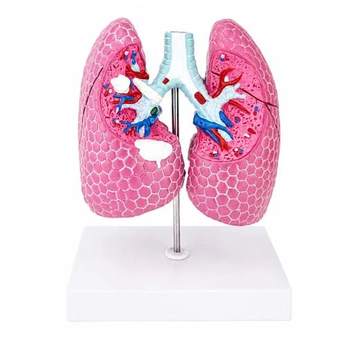 Life-Size Lung Pathological Model with COPD & Cancer